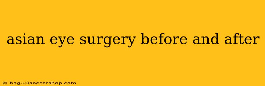 asian eye surgery before and after