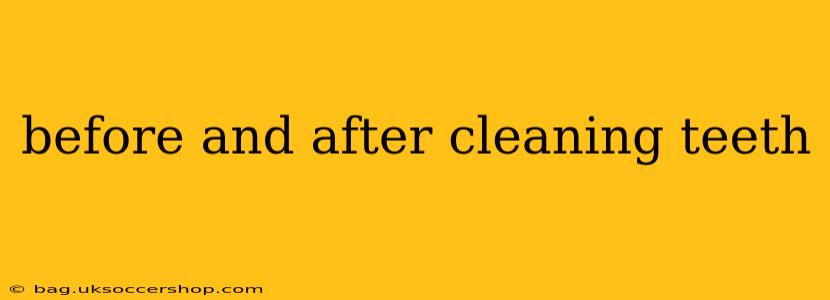before and after cleaning teeth