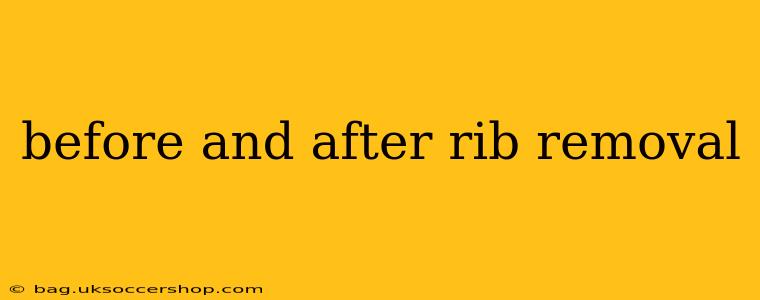 before and after rib removal