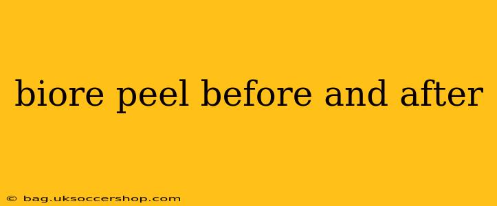 biore peel before and after