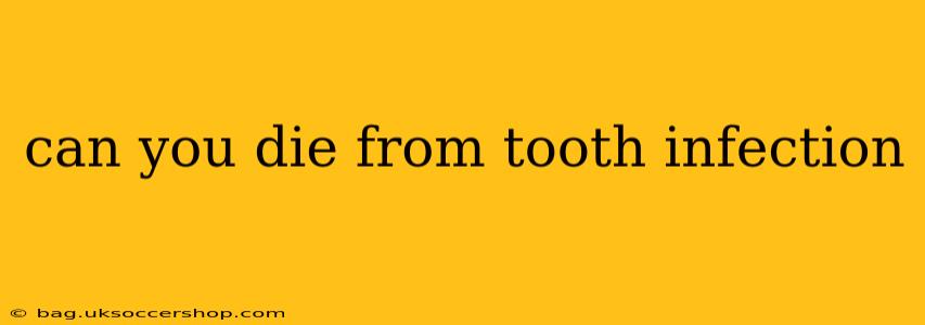 can you die from tooth infection