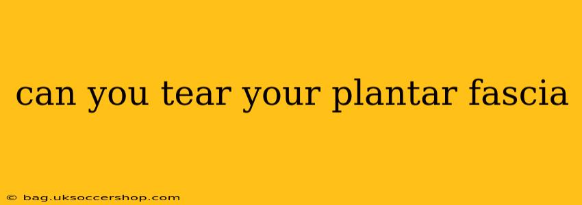 can you tear your plantar fascia