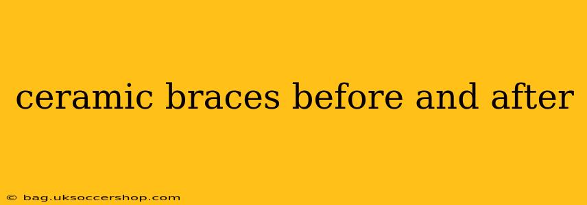 ceramic braces before and after