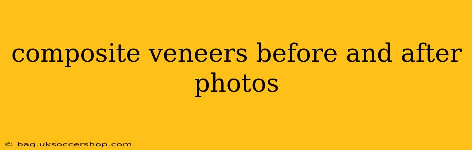 composite veneers before and after photos