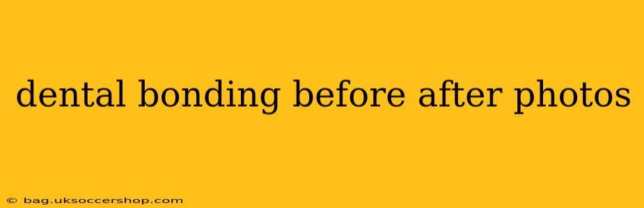 dental bonding before after photos