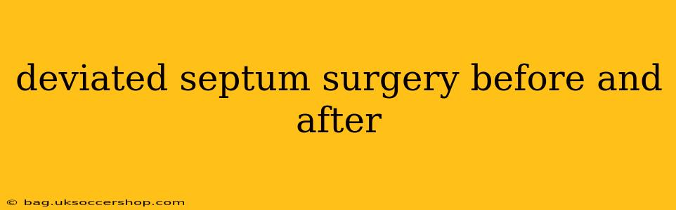 deviated septum surgery before and after