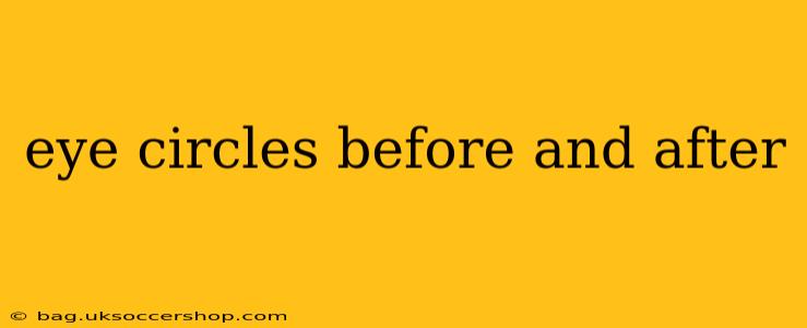 eye circles before and after