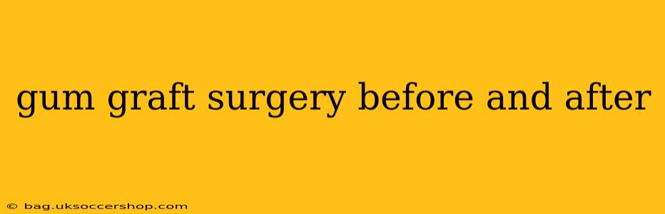 gum graft surgery before and after