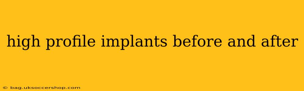 high profile implants before and after