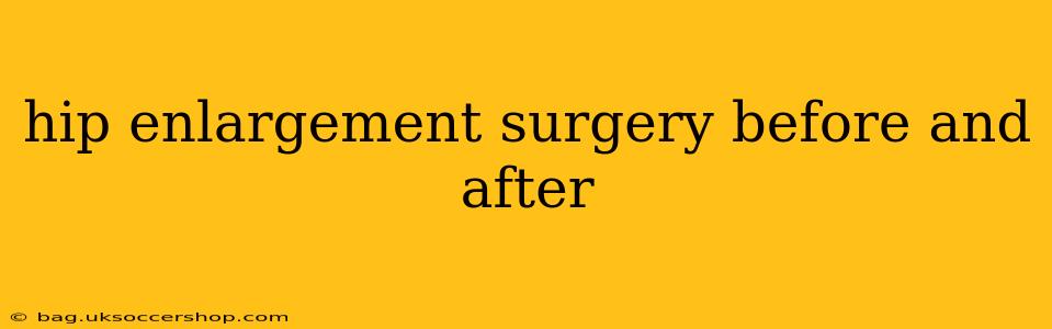 hip enlargement surgery before and after