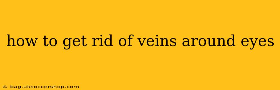 how to get rid of veins around eyes
