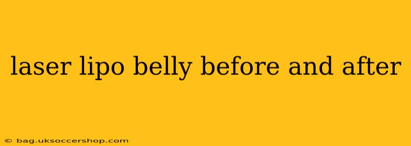 laser lipo belly before and after