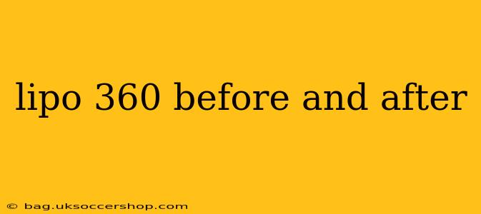 lipo 360 before and after