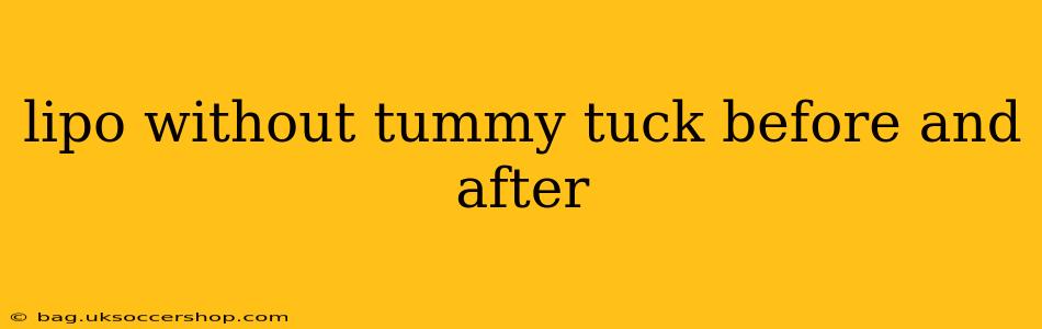 lipo without tummy tuck before and after