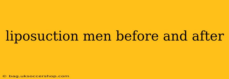 liposuction men before and after