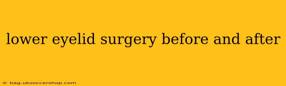 lower eyelid surgery before and after