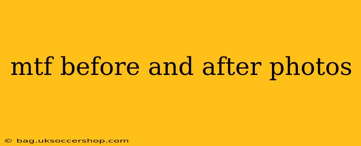 mtf before and after photos