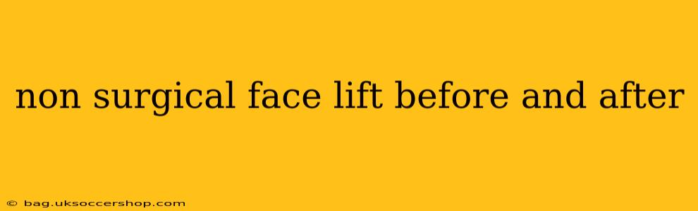 non surgical face lift before and after