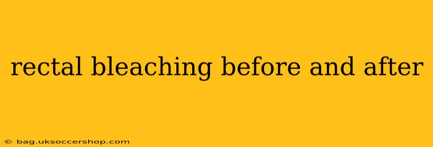 rectal bleaching before and after