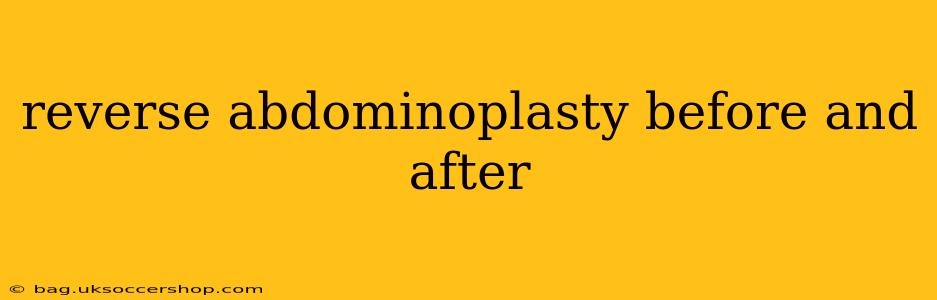reverse abdominoplasty before and after