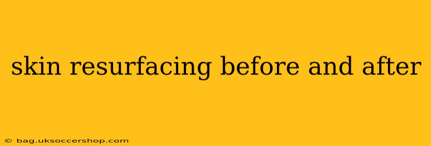 skin resurfacing before and after