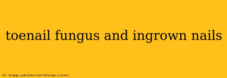 toenail fungus and ingrown nails