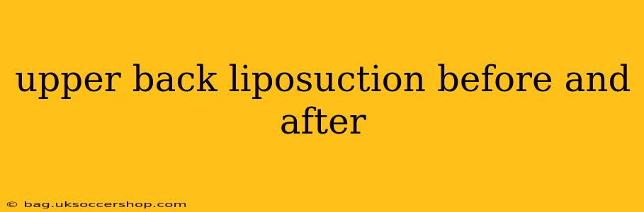 upper back liposuction before and after