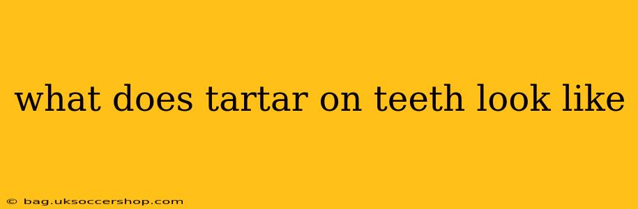 what does tartar on teeth look like